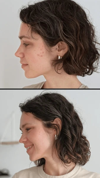 Treatment results